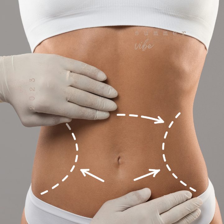 Historia Liposukcji i Lipotransferu: Ewolucja Zabiegów Modelowania Ciała