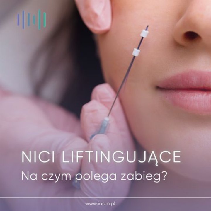 Nici liftingujące - Na czym polega zabieg?