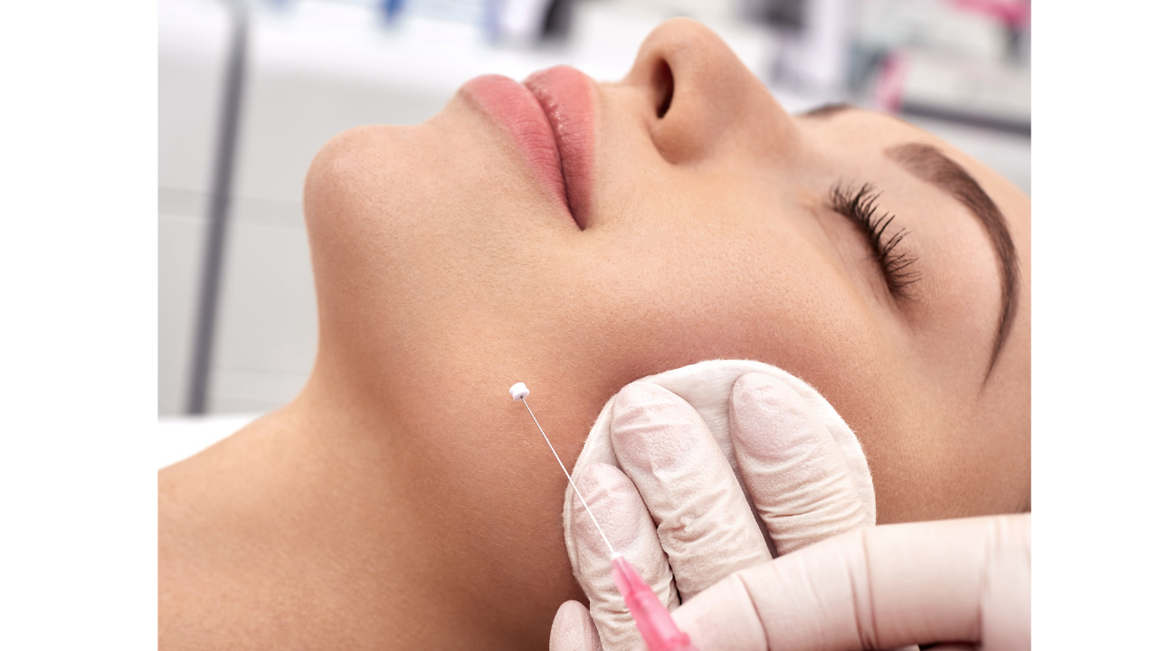 Planujesz wykonywać zabiegi z użyciem nici liftingujących? Musisz znać tych sześć zasad!